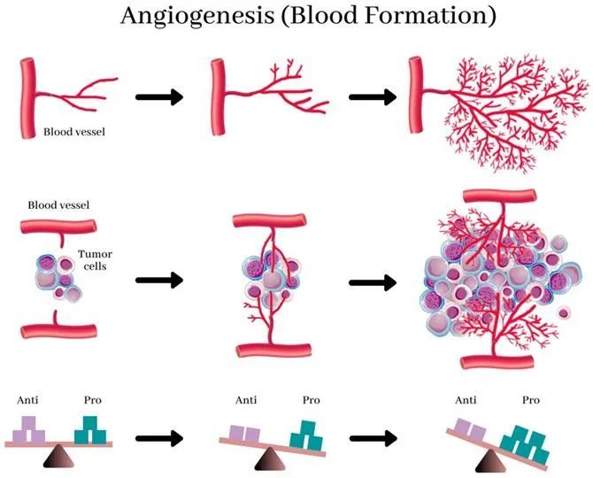 吃出健康平衡的血管生成防御系统"饿死"疾病"喂养"健康