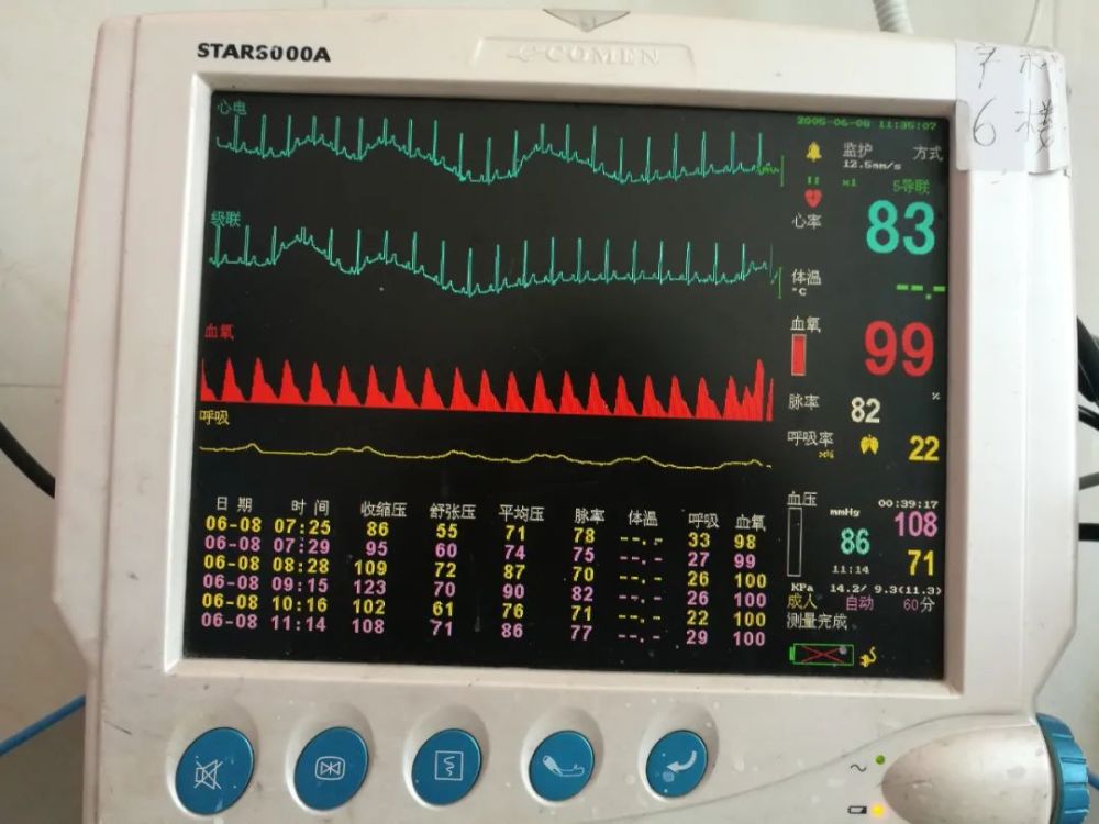 心电监护问题多多,万不可掉以轻心!