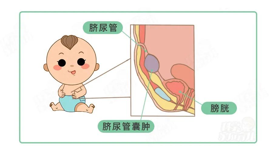 男宝被亲生父母划开肚脐放气!除这4种病外,别乱动肚脐