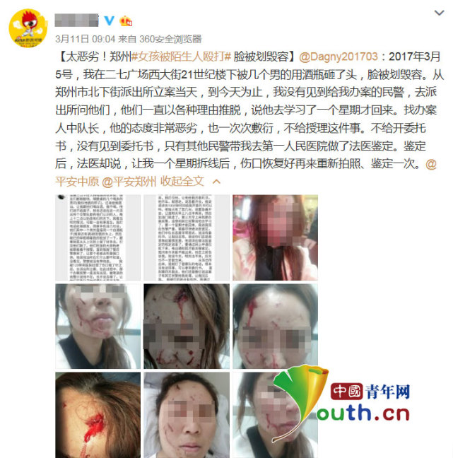 女子深夜在大排檔被酒瓶砸毀容 警方：正在抓捕嫌犯