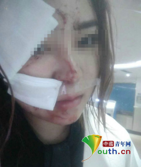 女子深夜在大排檔被酒瓶砸毀容 警方：正在抓捕嫌犯