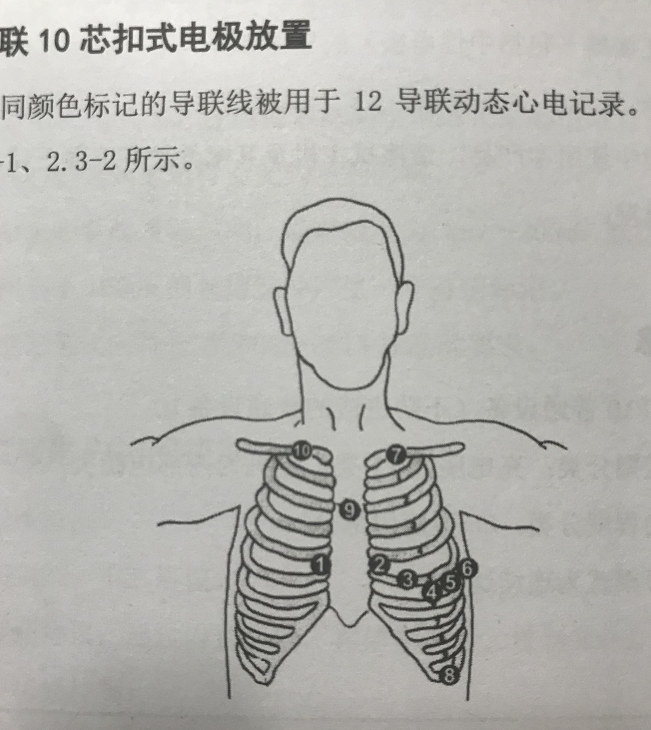 福州40名市民体验24小时动态心电检测