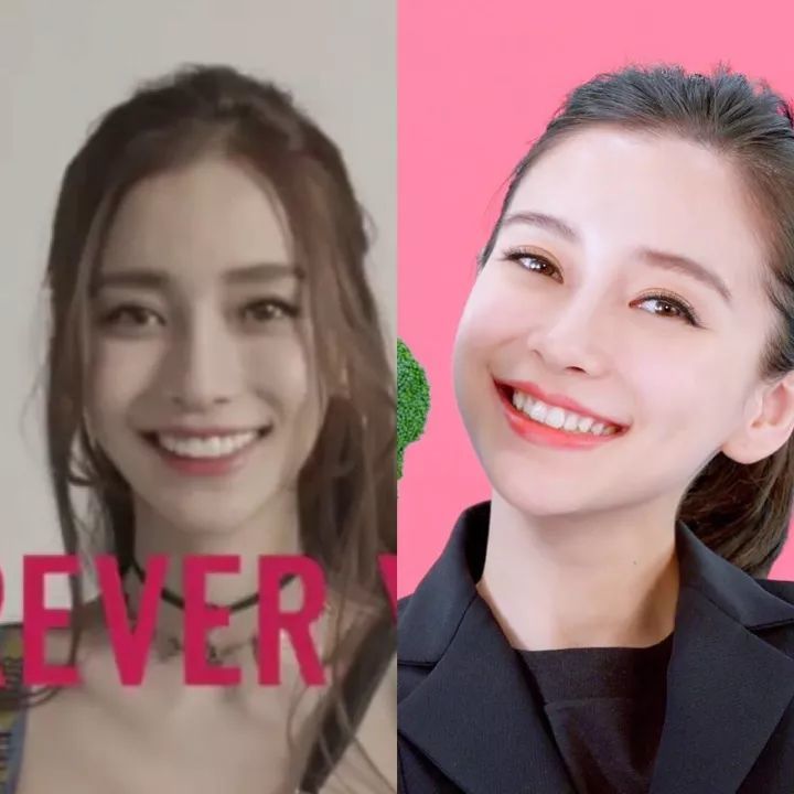 韩国某节目上,有女明星因为做了美容冠,连苹果都咬不动.