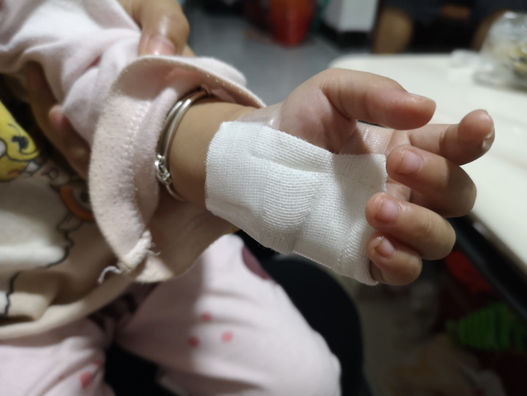 广西2岁女孩遭电梯夹伤手鲜血直流,原来电梯也有感应"