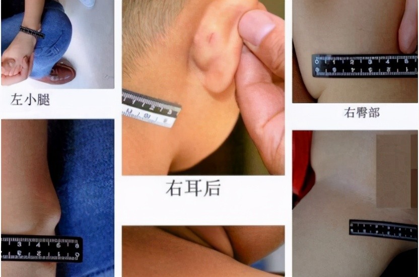 新时代的容嬷嬷,4岁男童被老师用针扎指甲缝,幼儿园却