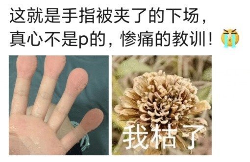 "这就是手指被夹了的下场,我枯了!"哈哈哈肿到让人心疼!