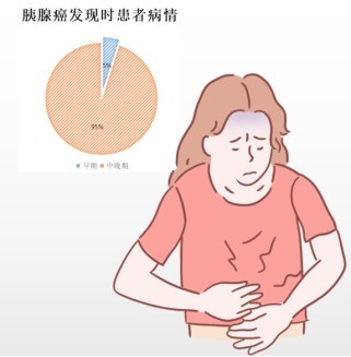让余欢水生不如死的胰腺癌,真的这么可怕吗_腾讯新闻