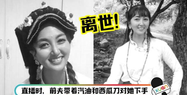 遭前夫洒汽油严重烧伤!中国网红拉姆坚持16天 不敌