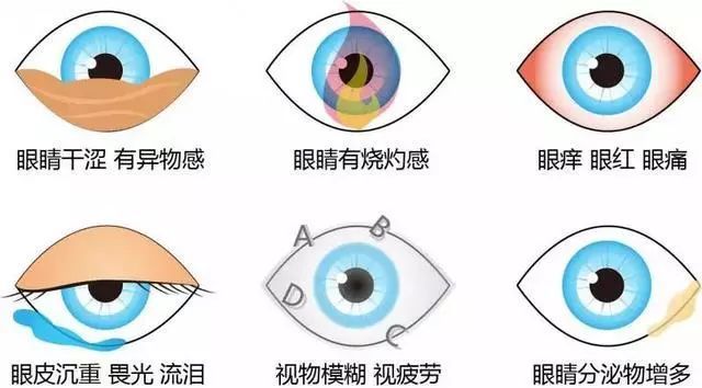 长期佩戴隐形眼镜的危害!