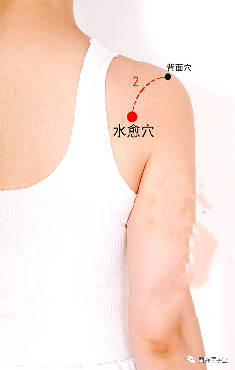 董氏奇穴针灸:水愈穴 l 水愈穴【穴位讲解】