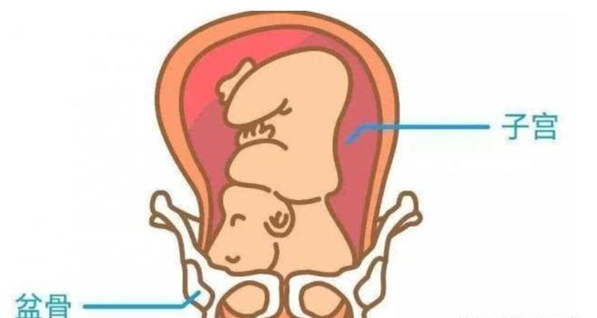 胎位不正怎么纠正（胎位不正怎么纠正方法）