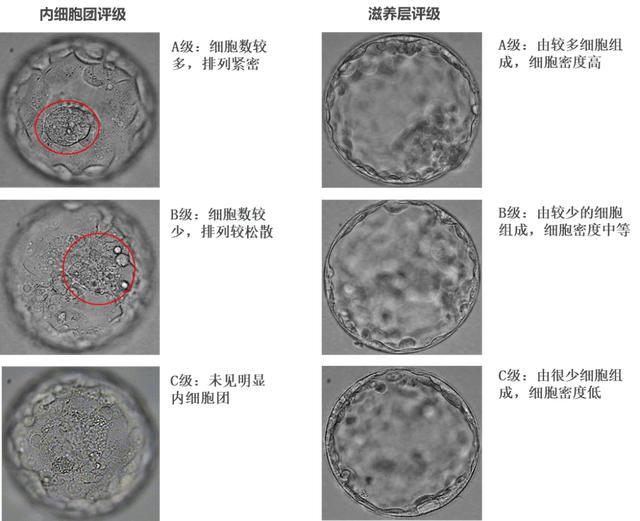 不瞒您说,胚胎质量也有等级之分,长得"好看"才能移植?