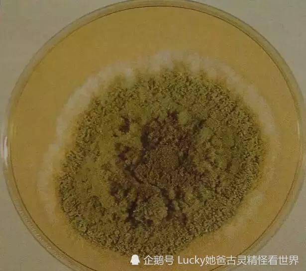 什么是黄曲霉素?