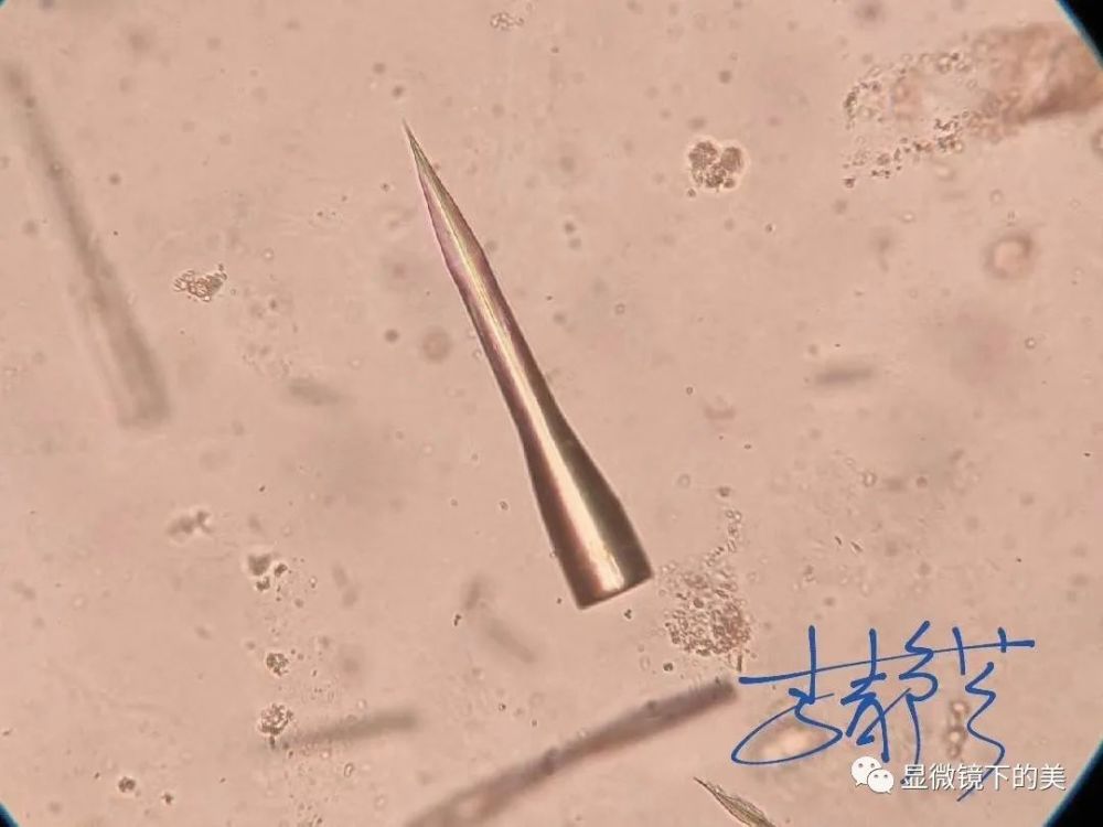 显微镜下可见菱形,三棱形,长方形,斜方形的结晶物,呈黄色或暗褐色,可