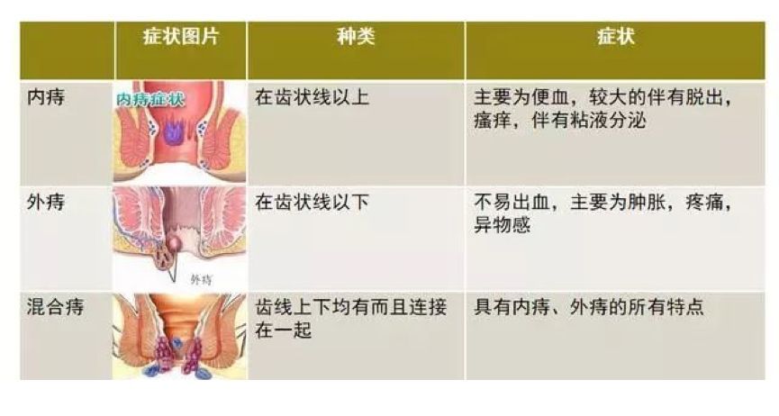 在直肠和肛门之间的位置有一个结构叫齿状线,以齿状线为界限,根据发生