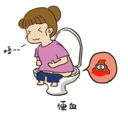 了解肛门息肉吗?一旦患上需要做什么检查