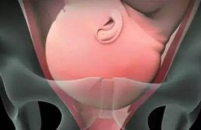 女性顺产"开十指"有多宽?镜头直击全程,赞叹母爱之