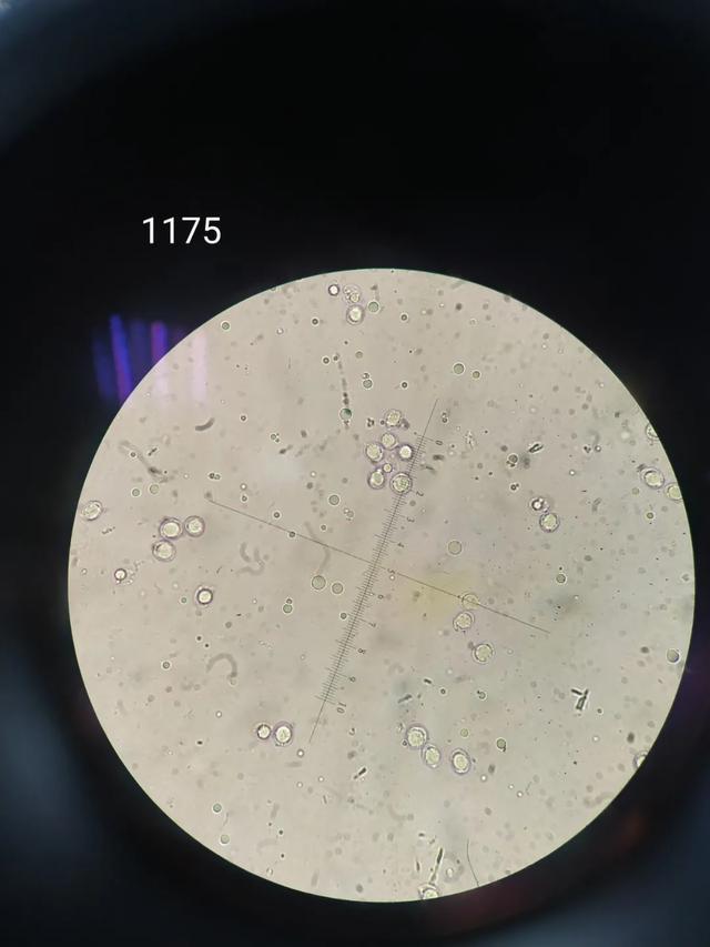 显微镜下的毒蘑菇—假球基鹅膏