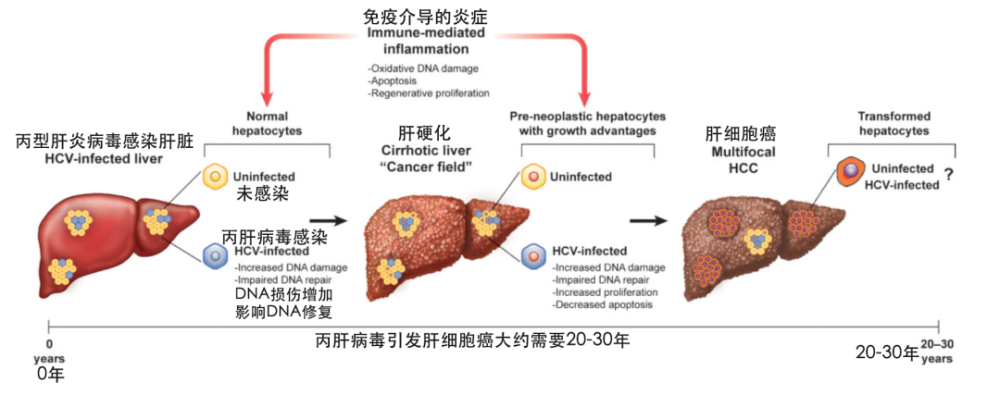 被诺奖带"热"的丙肝,原来是肝硬化和肝癌的重要元凶