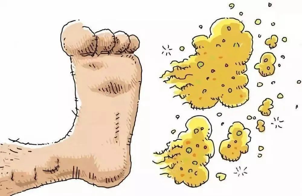 为发生在掌,跖与指,趾间皮肤的浅部真菌感染.