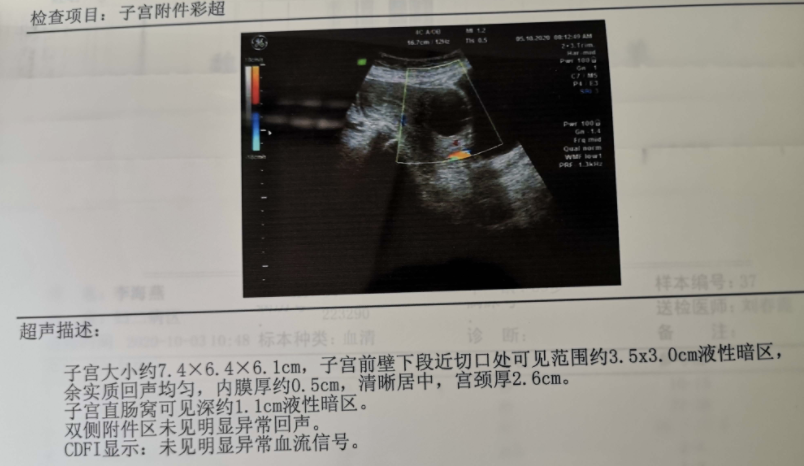 瘢痕子宫切口处 3.4×3.2 cm 液性暗区考虑什么?
