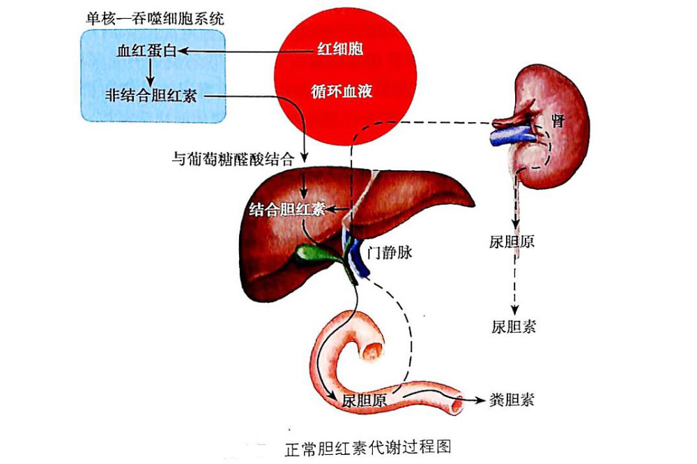 胆红素高一般会是什么病?胆红素的来源及代谢