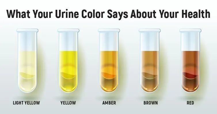 尿液正常的颜色应该是 淡黄色,这是最理想的情况.