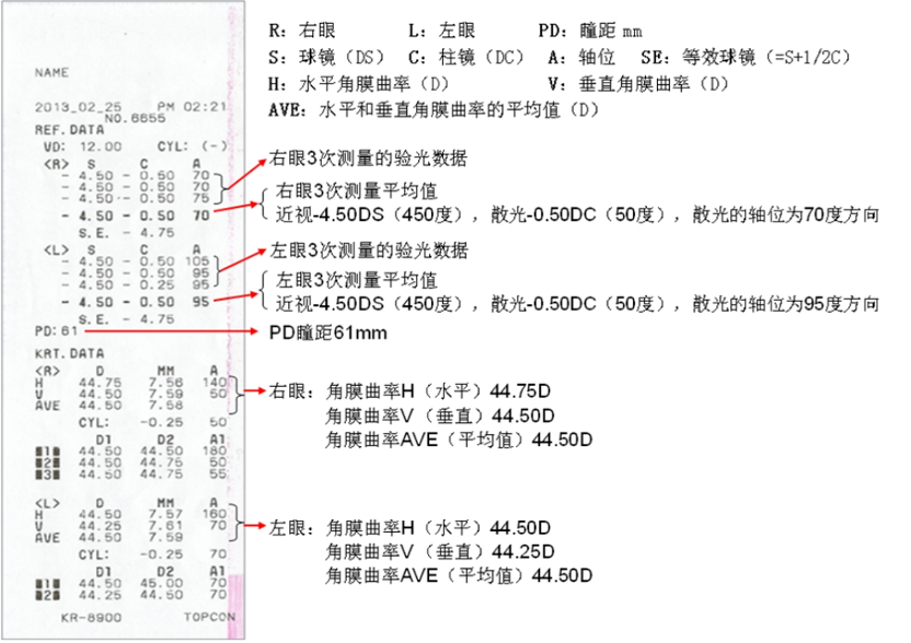不要怕,教你轻松读懂验光单