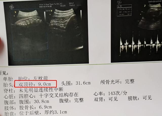 胎宝头部大小代表着什么第4种情况不用担心附胎宝发育对照表