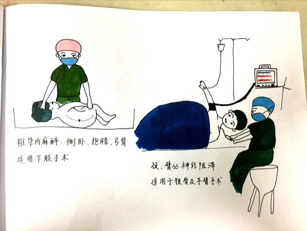 手术室护士变身"灵魂画手" 用漫画描绘患者手术之旅