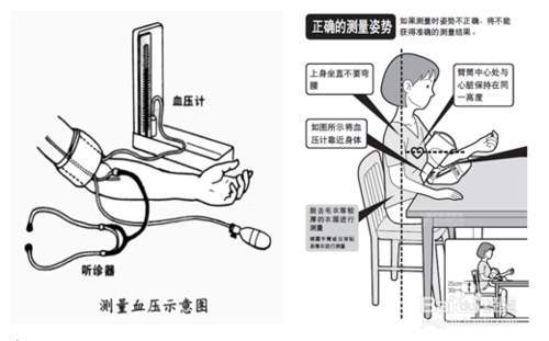 值,舒张压93毫米汞柱属于1级高血压,脉压差130-93=37mmhg在正常范围