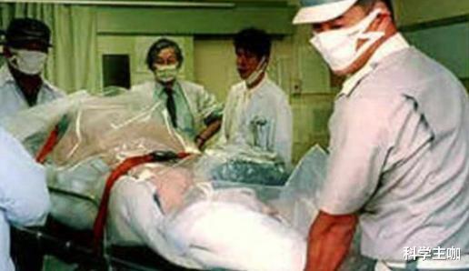 死法最痛苦的日本人:遭核辐射后想安乐死,却被强行续命83天