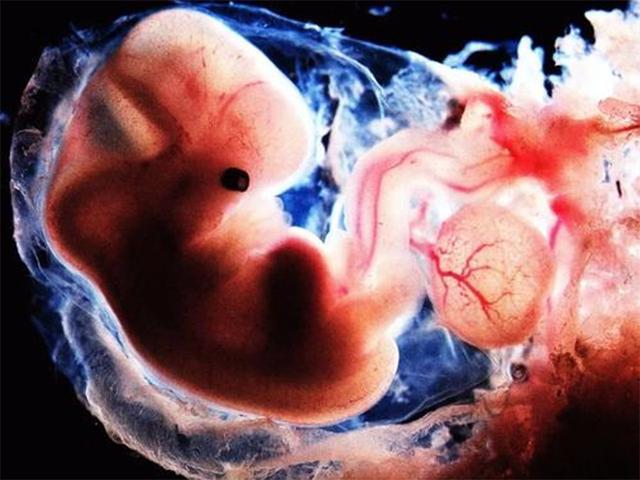 怀孕53天胎儿的样子是怎样呢?