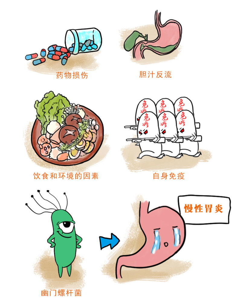 像这些原因,都会导致慢性肠胃炎的发生.