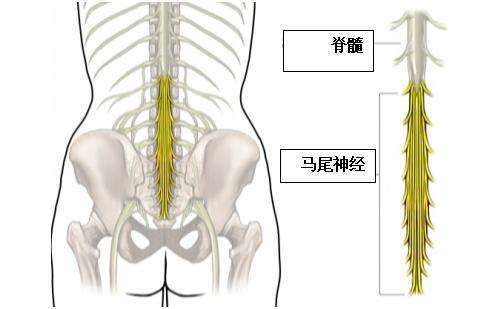 马尾综合征|脂肪变性|马尾神经|脊髓