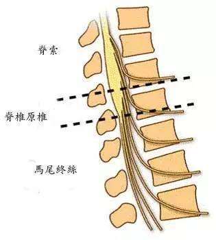 马尾综合征|脂肪变性|马尾神经|脊髓