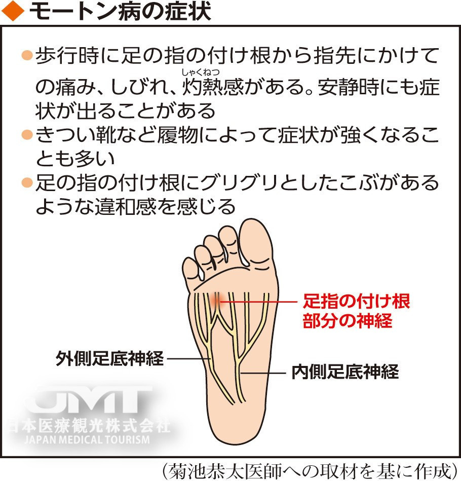 脚趾根部疼痛的"莫顿病",因被压迫而刺激神经发病