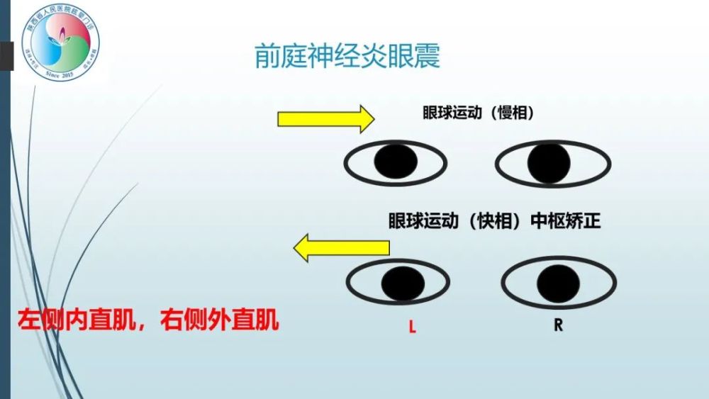 腾讯形排