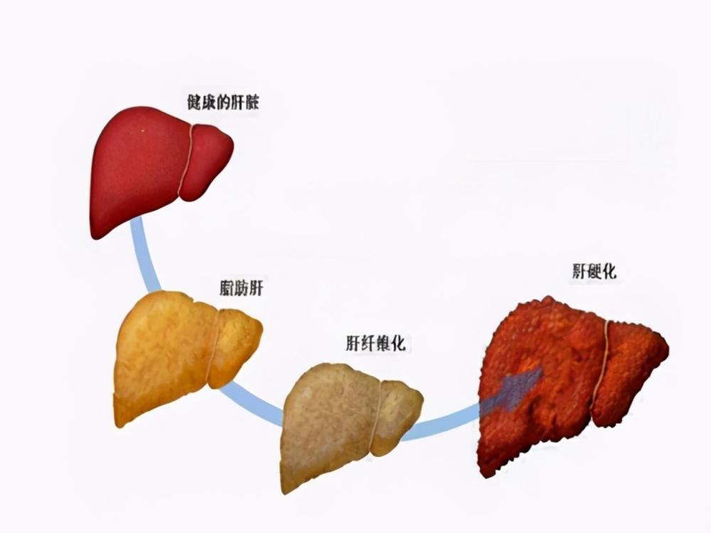 肝脏具有调节身体内分泌的作用,它若是出现病变,那么对人的健康会产生