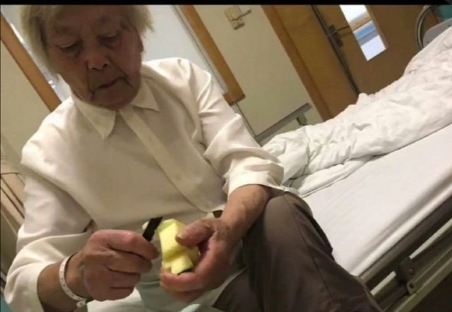 做磁共振可以穿内衣吗(3)