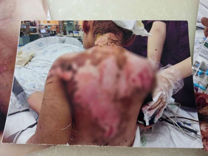 女童被虐生命垂危，姥姥要报警却收到威胁