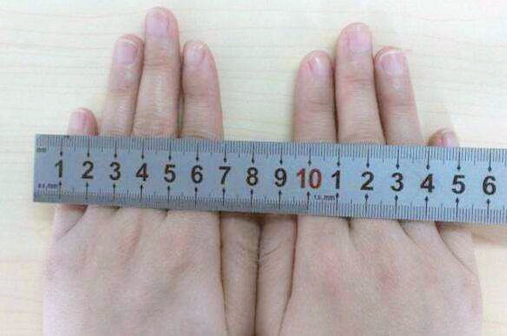 开十指是开到多少厘米?真是十根手指那么宽?别当妈了还搞不清