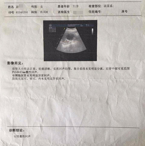 身体不痛不痒,却查出肾囊肿?3种特征的肾囊肿很危险!