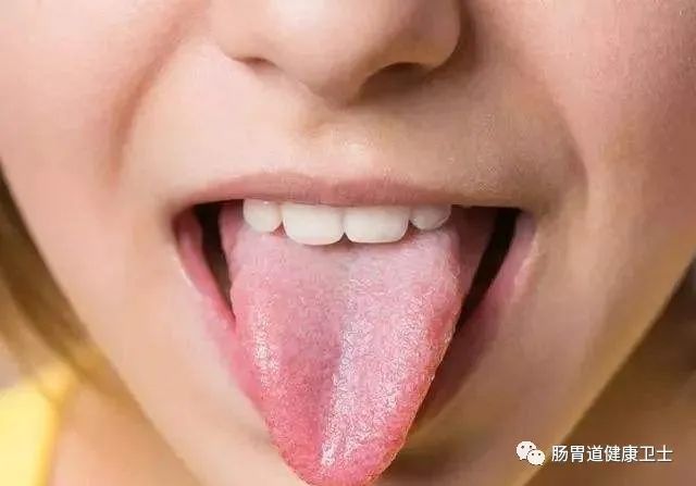 看舌头,知全身,如何从舌头看健康,五类舌象对应疾病该
