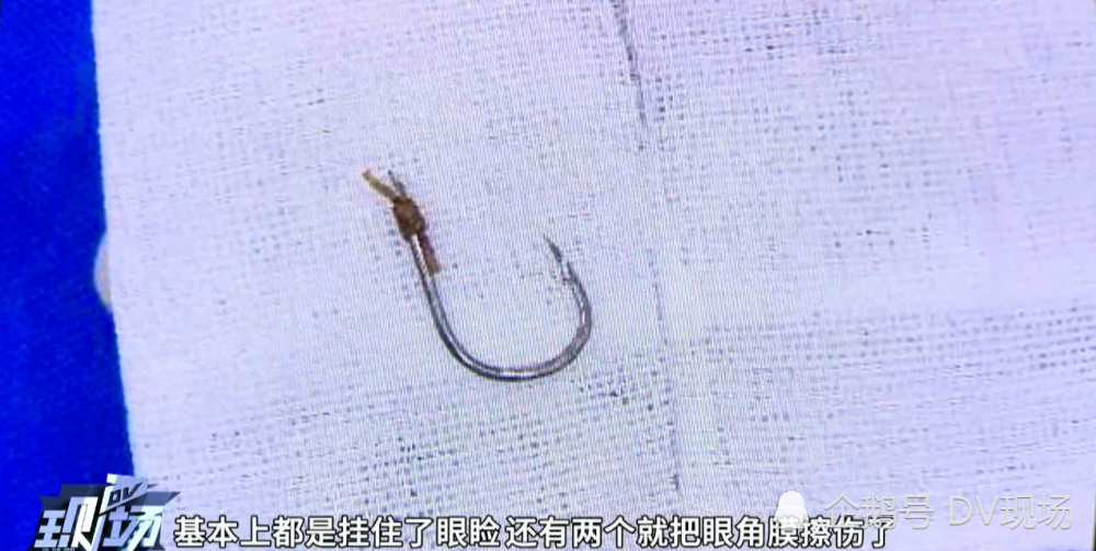东莞:男子持弹弓鱼镖射鱼,竟意外射进自己脖子5厘米
