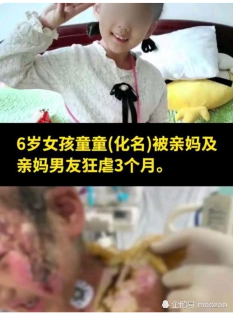 抚顺6岁女童被虐造成体表重伤二级,那些离异父母的该反思