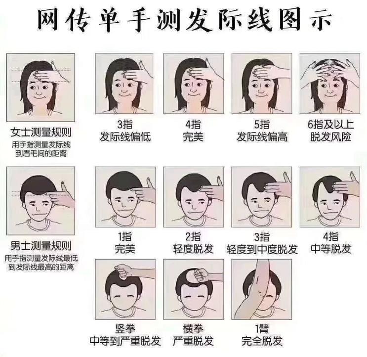 怎么才知道自己是发际线高?一张图告诉你!