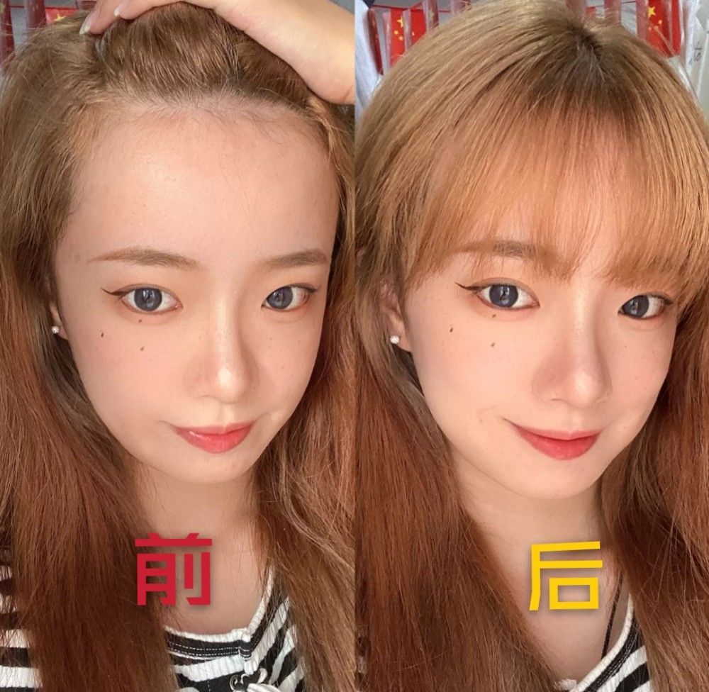 发际线高的女生,可别乱剪头发!换对这4种"刘海",减龄显脸小
