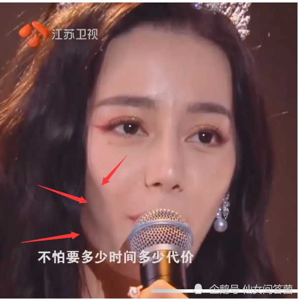 不得不说,粉丝的眼神是对的,我们看热巴脸上那几条明显的大v线,可不就