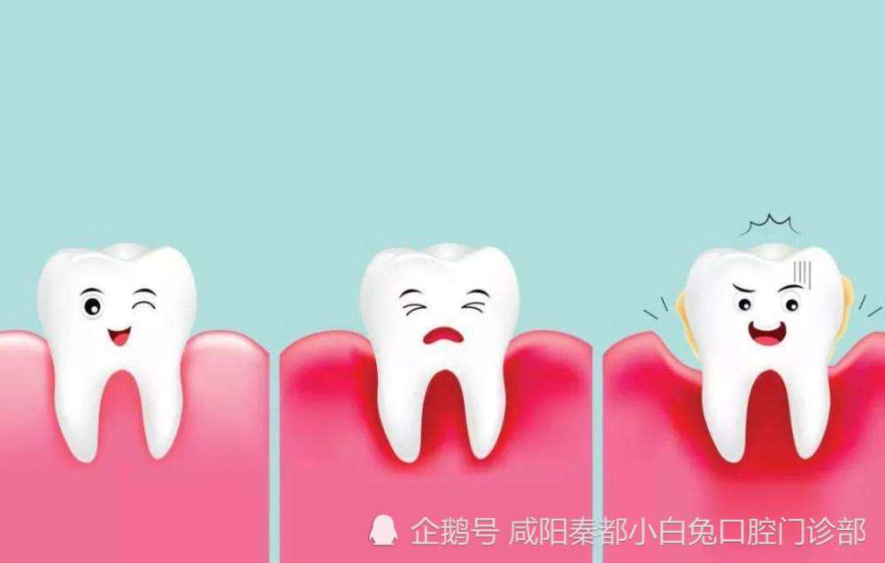 它的主要危害就是让原本包裹牙齿的牙龈发炎造成附着丧失,继而引发